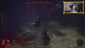 hit me so hard he left me Bald! 😮